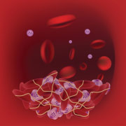 Pictogramme pour la maladie thromboembolique