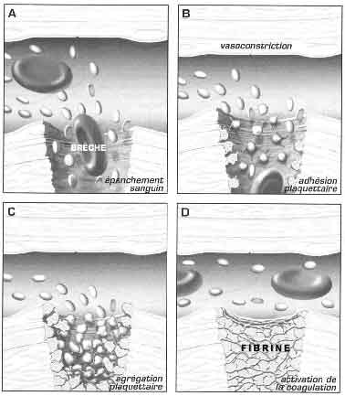 Schema of a breach plugging to ensure Haemostasis