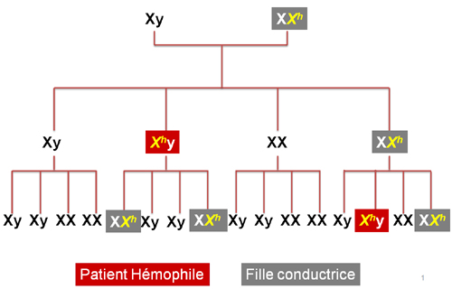 Schéma de l'origine et de la transmission de l'Hémophilie A