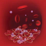 Pictogram for the venous thromboembolism